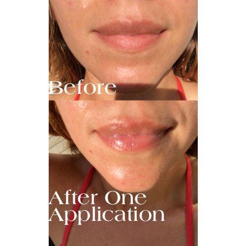 Rose Glow Honey Lip Balm Elixir