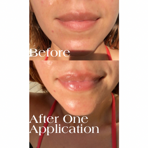 Rose Glow Honey Balm